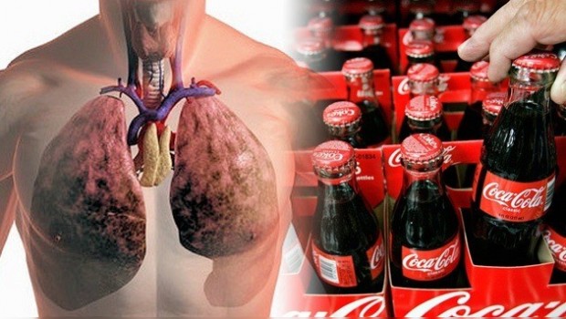 Adicto a la Coca-Cola muere con los pulmones hinchados 4 veces más de lo normal