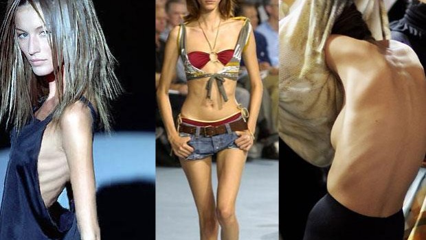 La nueva tendencia entre modelos para bajar de peso: malla adelgazante