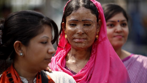 Cuatro mujeres graves tras ser atacadas con ácido en Pakistán