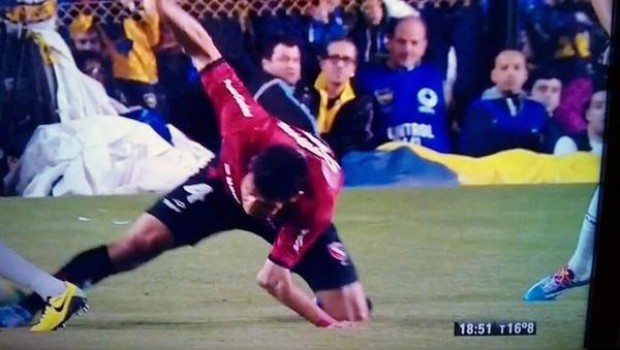 VIDEO: Escalofriante lesión en el NOB vs Boca Juniors